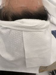-苑苑vbeauty科技美容SPA