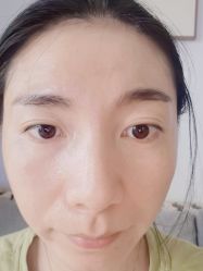 体验后-瑞鑫创美·高定轻医美
