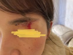 -大华韩艺整形美容医院