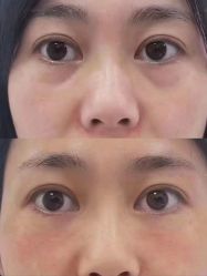 -Yestar重庆艺星医疗美容医院