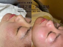 -禾壹净·素颜美问题肌肤修护中心