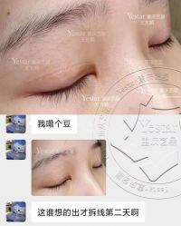 -Yestar重庆艺星医疗美容医院
