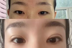 -成都西区医院整形美容