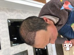 -大麦微针植发丨全国连锁