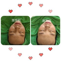 -苗方清颜·祛痘皮肤管理