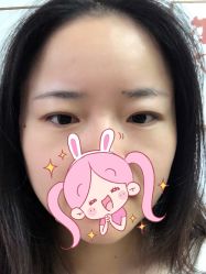 -北京米扬丽格医疗美容·联合丽格鼻整形中心