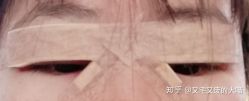-西安壹加壹医疗美容医院