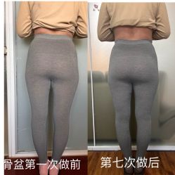 点击看大图 -产后帮产后修复(首城国际店)