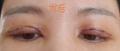 体验后-北京京通医院医疗美容