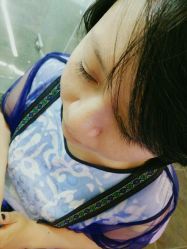 -薇兰专业脱毛连锁机构