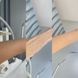 -植蔻妍倍儿专业脱毛·皮肤管理