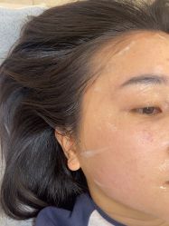 -长沙雅美医疗美容医院