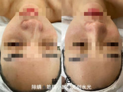 -LUNA皮相美·骨相美高级美感