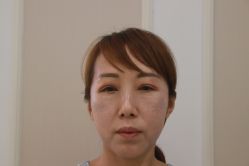 -万州华美紫馨整形美容医院