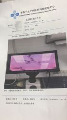 -派恩宜灰指甲鸡眼嵌甲手足癣