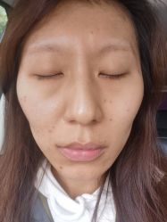 体验后-天津伊美尔医疗整形美容专科医院