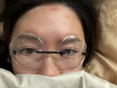 -黑马眼科·近视手术