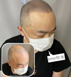 -西施无菌半永久纹绣眉眼影唇轻增发纹发际线