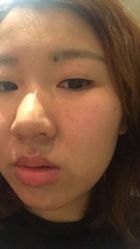 -IRIS韩国皮肤管理中心