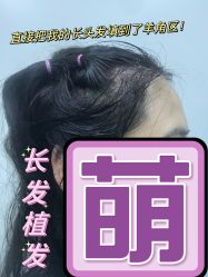 -杭州医巢医疗美容