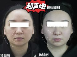 -Yestar重庆艺星医疗美容医院