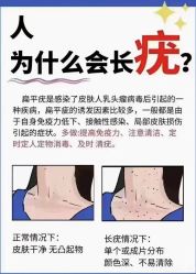 -克丽缇娜