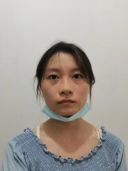 体验前-肌遇皮肤管理中心
