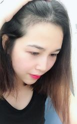 -大麦微针植发全国连锁