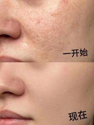 -LUNA皮相美·骨相美高级美感