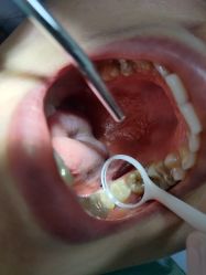 体验后-深圳春天阳光医院·轮廓抗衰中心