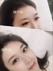 点击看大图 -西施无菌半永久纹绣眉眼影唇轻增发纹发际线