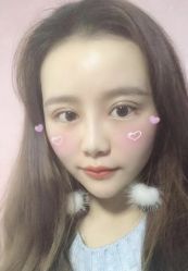双眼皮就是美哈哈哈-静港气质医美