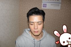 -大麦微针植发丨全国连锁