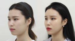 -CMS西美斯·美式医疗美容