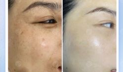 -美肤盾祛痘·问题肌头疗管理中心