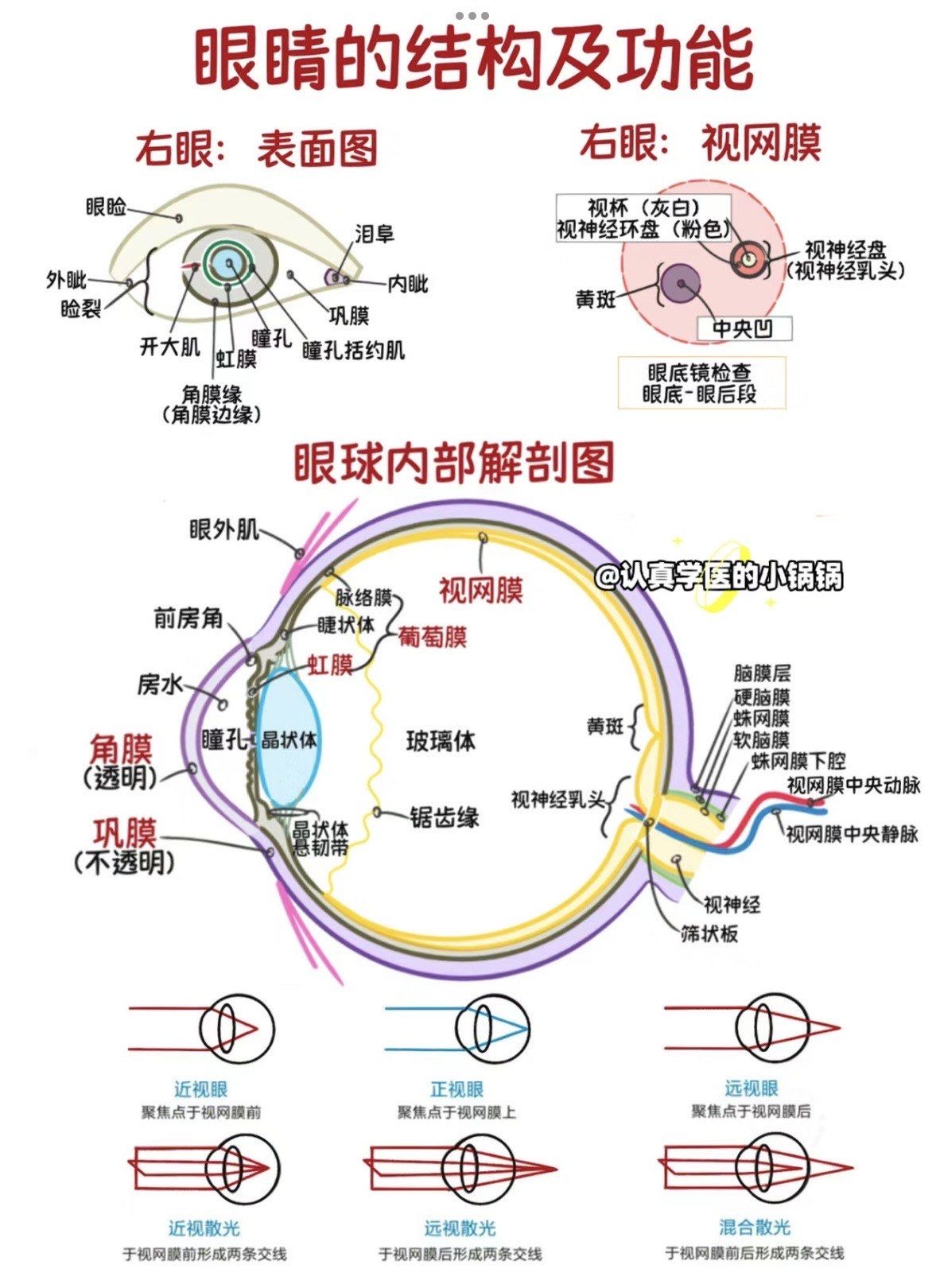 负责对焦光线,使其准确聚焦在视网膜上.5.玻璃体