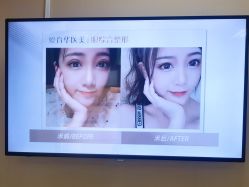-北京爱育华医院-医疗美容科