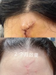 -痣斑堂·取大痣