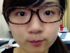 两个月后，眼皮已经很自然-上海华安整形外科门诊部