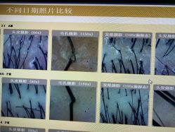 -丝客富脱发养发头皮馆