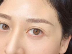 -德绣·机器野生眉发际线·美瞳线半永久