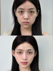 -宁波美莱整形美容