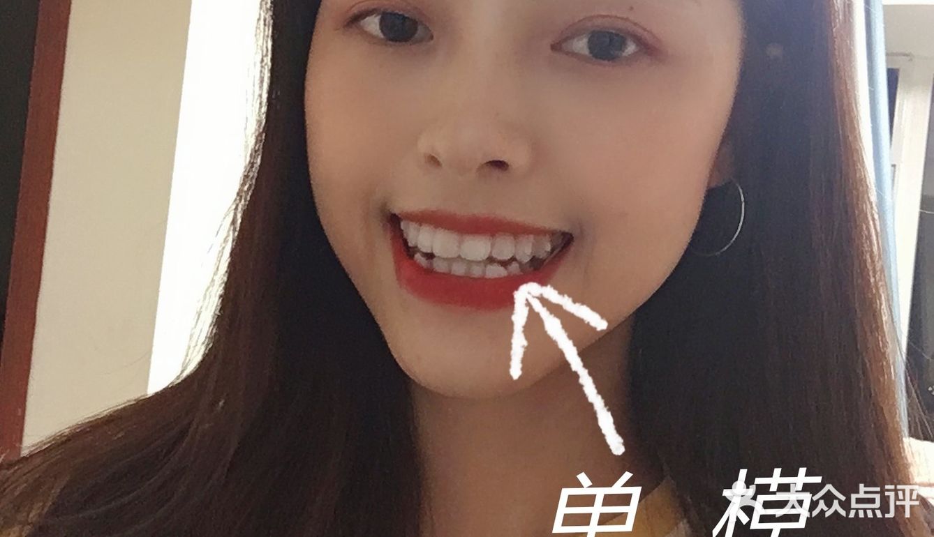 牙齿矫正-时代天使单模和双模的区别