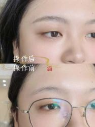 -西施无菌半永久纹绣眉眼影唇轻增发纹发际线