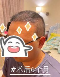 -雍禾植发全国连锁