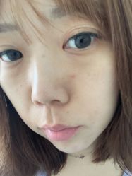 -宜肤清颜专业祛痘问题肌修护