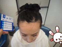 -大麦微针植发丨全国连锁