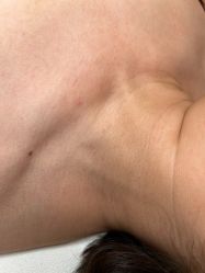 -清疣美疣·痣·斑净肤中心