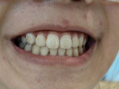 -同步齿科·数字化正畸种植口腔中心(珠海店)