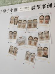 -菊子小颜·日式整骨·产后管理